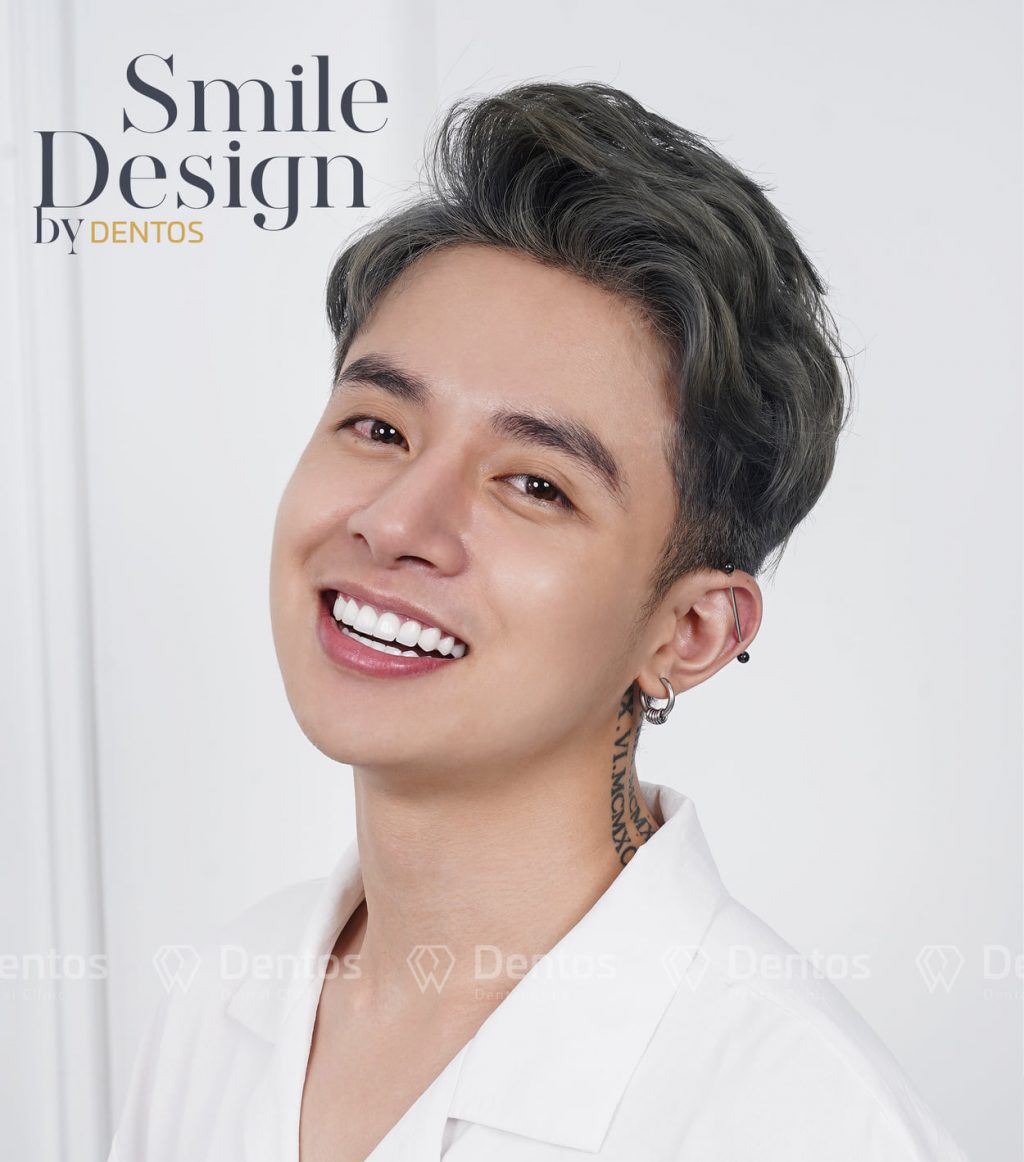 Chương trình ưu đãi lớn chưa từng có tại Dentos đã chính thức diễn ra trong tháng 7 và tháng 8 này